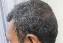 Seorang Warga Alami Kekerasan Polsek Cileungsi Lakukan Investigasi Penyelidikan