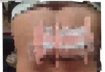 Buruh Alami Luka Robek Akibat Serangan Golok Dugaan Penganiayaan Polsek Cigudeg Lakukan Investigasi Penyelidikan Lebih Lanjut