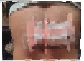 Buruh Alami Luka Robek Akibat Serangan Golok Dugaan Penganiayaan Polsek Cigudeg Lakukan Investigasi Penyelidikan Lebih Lanjut