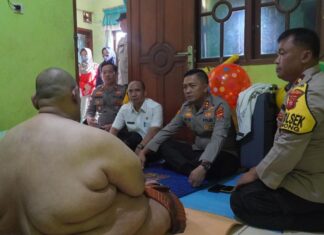 Kapolres Bogor Jenguk Penderita Obesitas di Cibinong, Berikan Bantuan dan Dukungan Moril Serta Medis